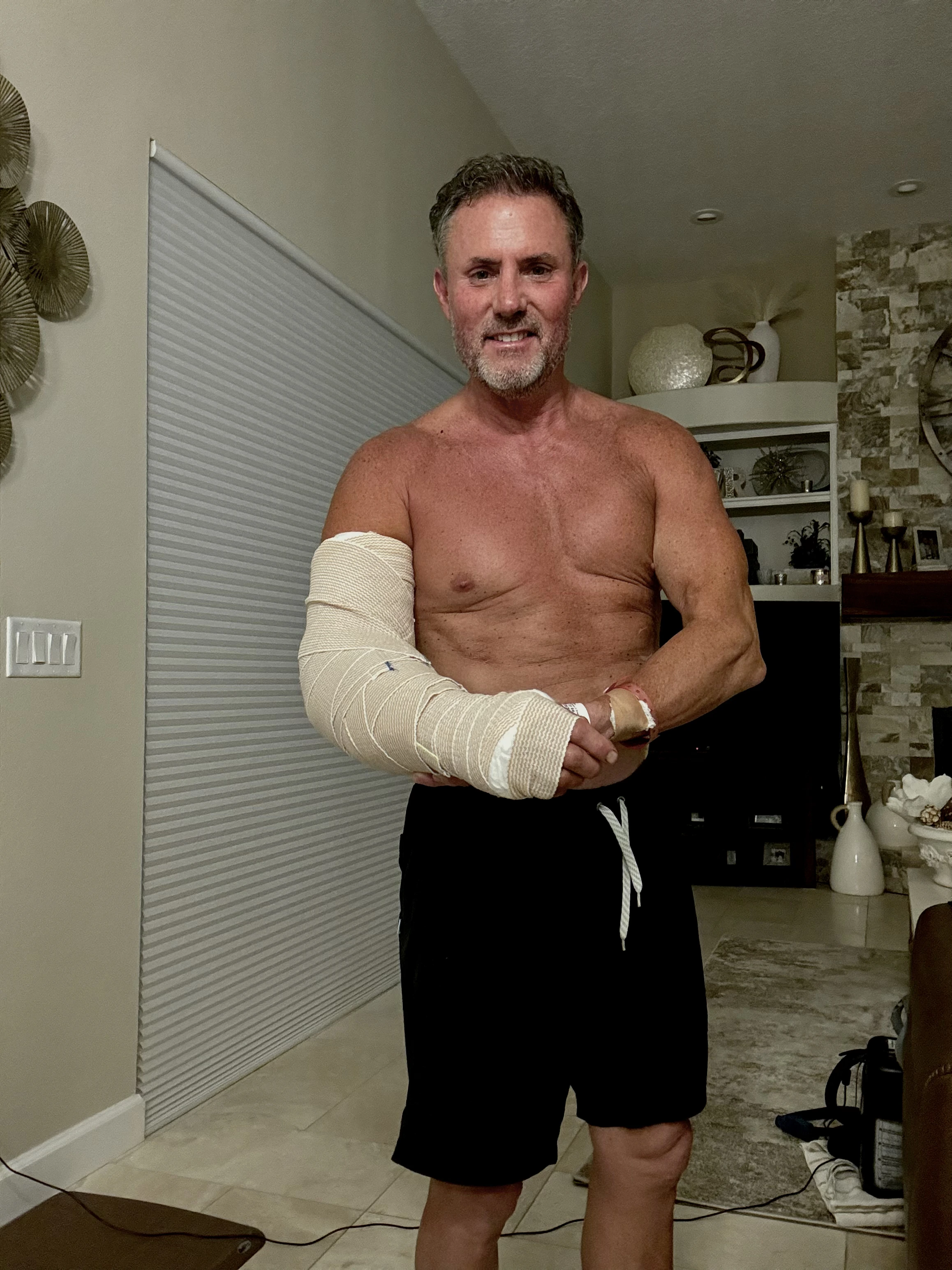 Injury impact on MS